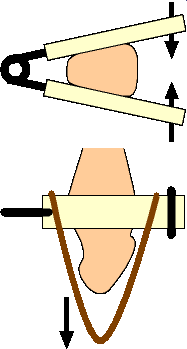 AFB penis weight hanger diagram